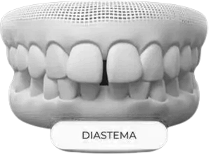 AnyConv.com__4-removebg-preview