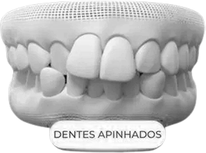 AnyConv.com__6-removebg-preview