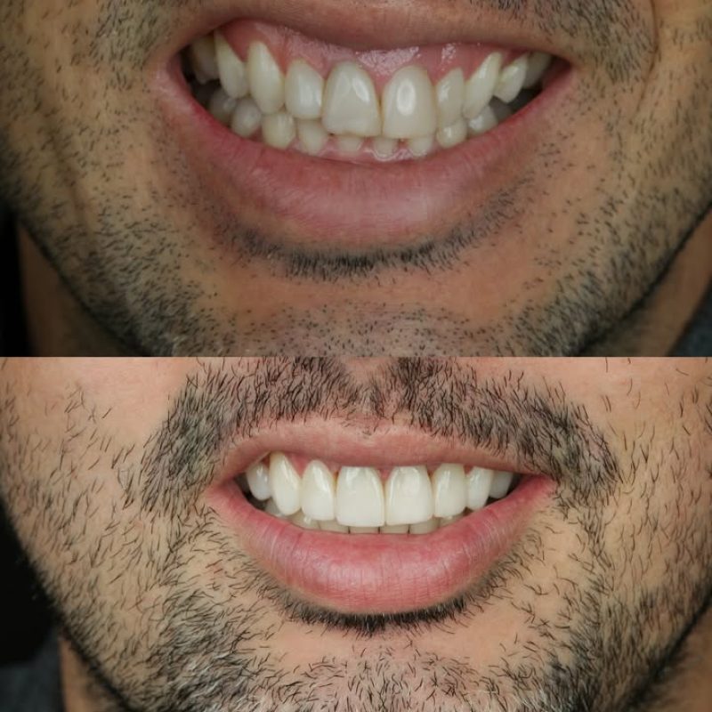 orto2